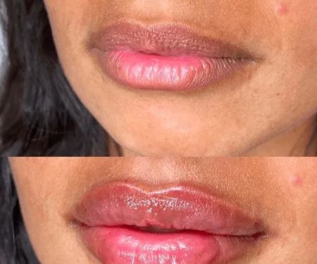 Simply Nourishing Medi-Spa