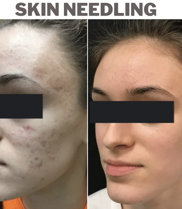 Hana Beauty and Med Spa Picture 4