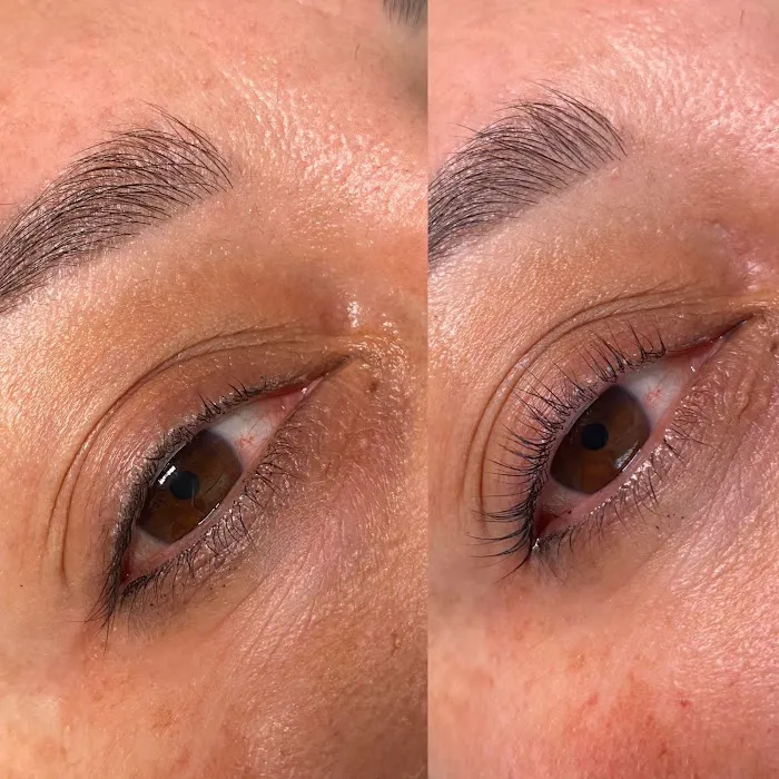 Renee Aesthetics Picture 2