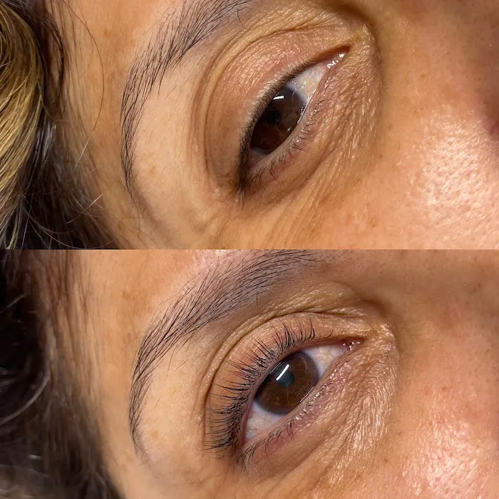 Renee Aesthetics Picture 3