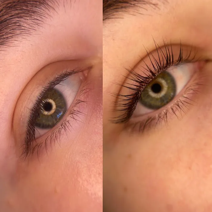 Renee Aesthetics Picture 6