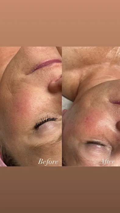 Renee Aesthetics Picture 7