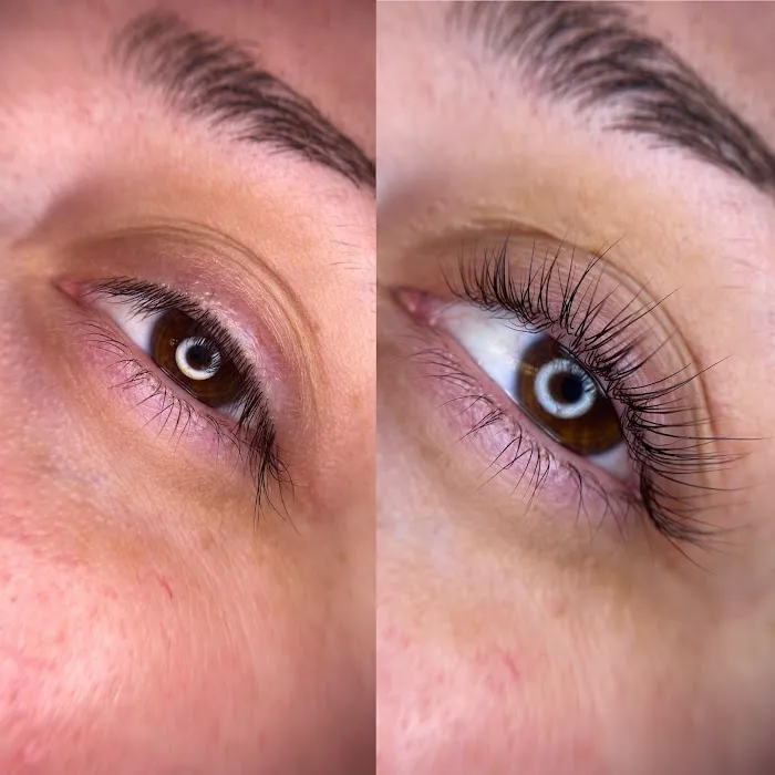 Renee Aesthetics Picture 8