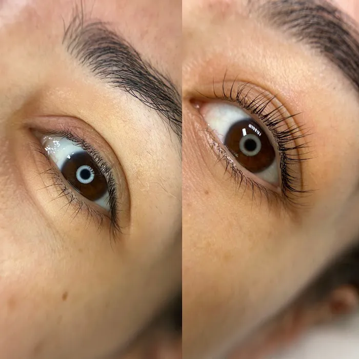 Renee Aesthetics Picture 10