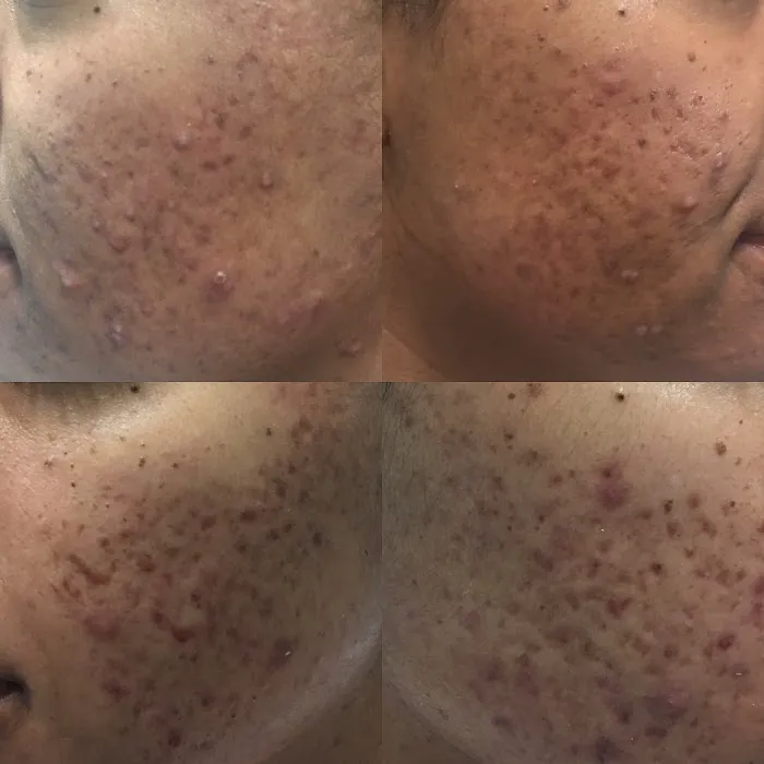 Michelle Marie Clinical Picture 9