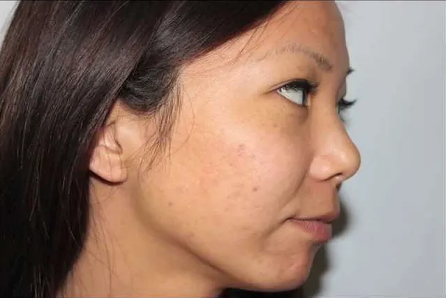 KIM VAN AESTHETICS, INC Picture 9