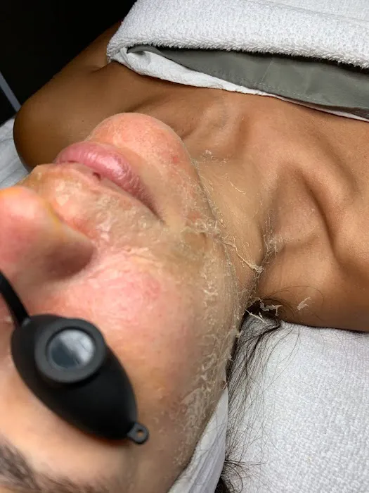 Best Face Forward Picture 10