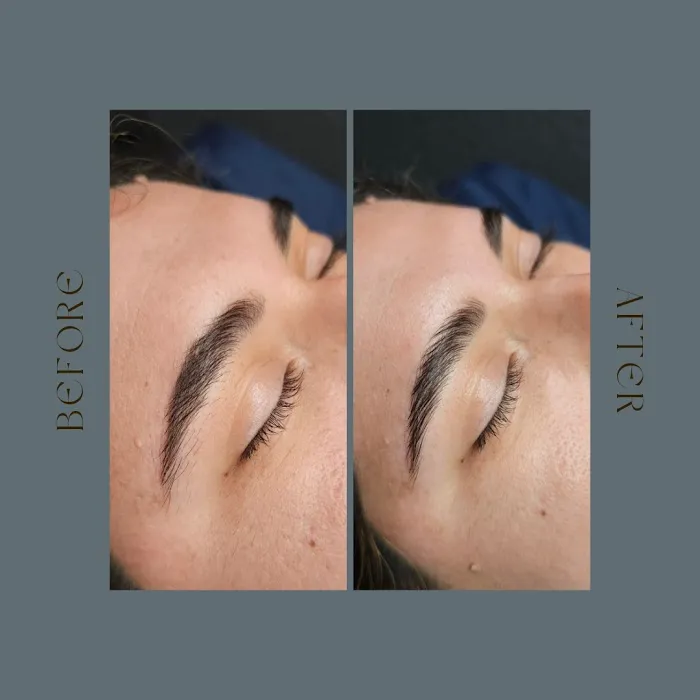 Skin by Lo Picture 6