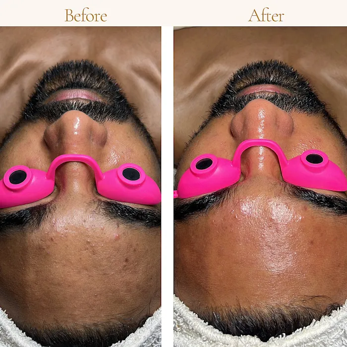 Sieved Botanics Picture 3