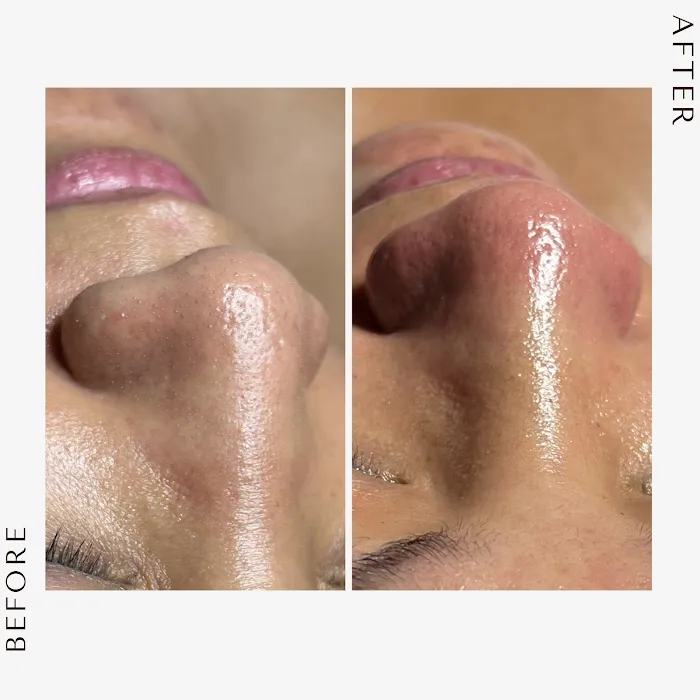 Sieved Botanics Picture 2