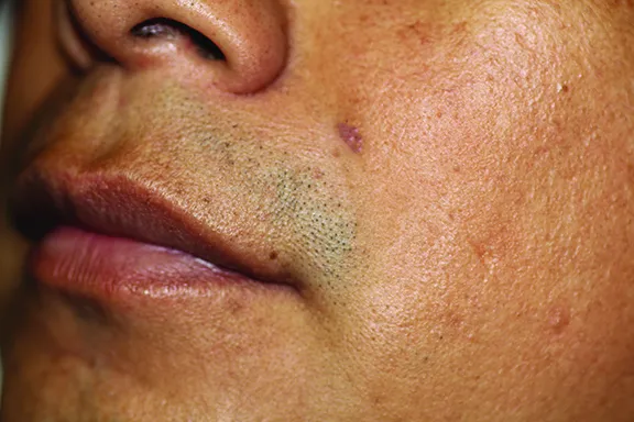 Upper Layers Skin Care Picture 2