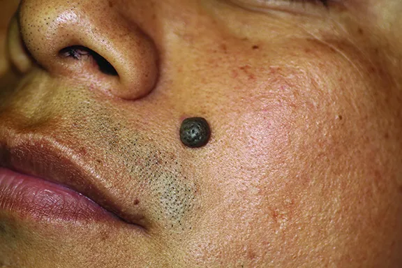 Upper Layers Skin Care Picture 6