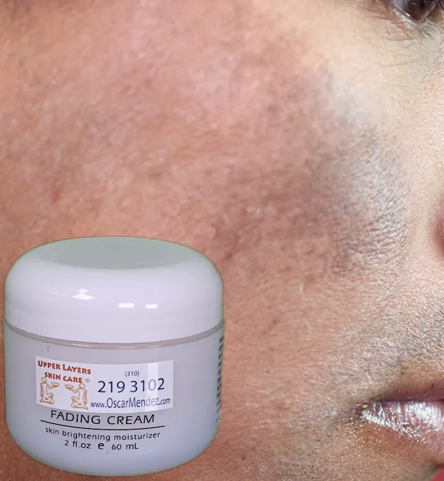 Upper Layers Skin Care Picture 8
