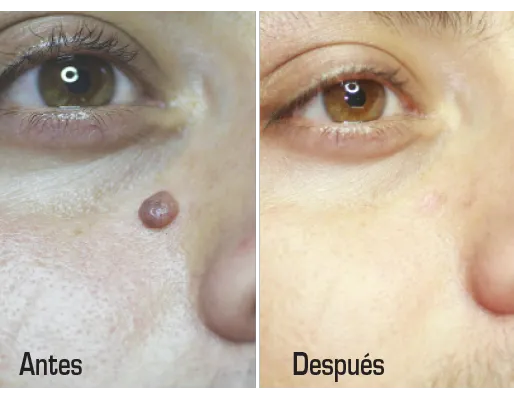 Upper Layers Skin Care Picture 9