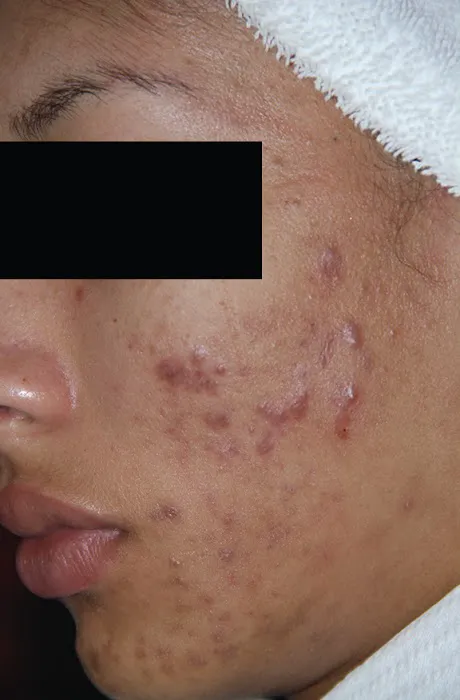 Upper Layers Skin Care Picture 10