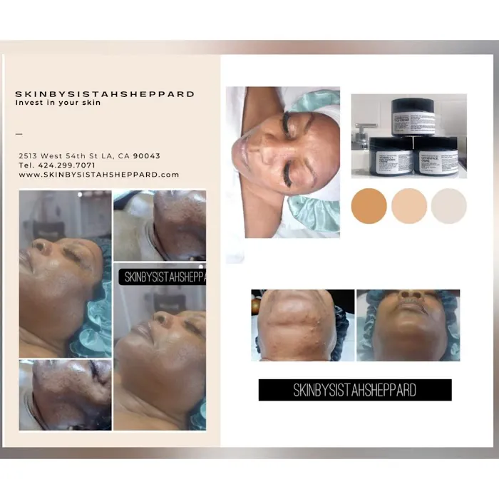 SKIN BY SISTAH SHEPPARD Picture 5