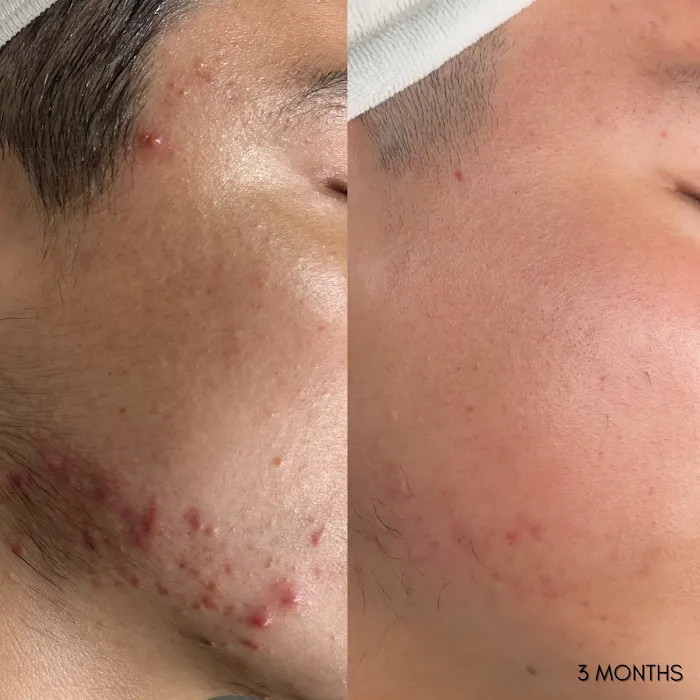 glowbeautyla Picture 5