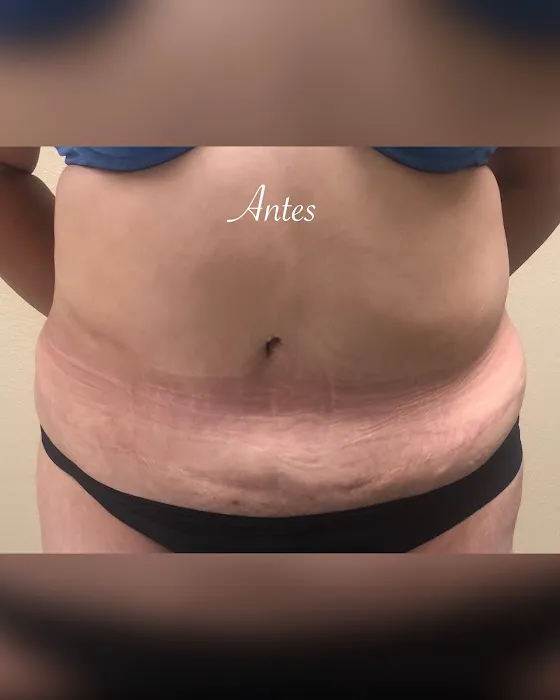 Oshun Body Wrap Picture 8