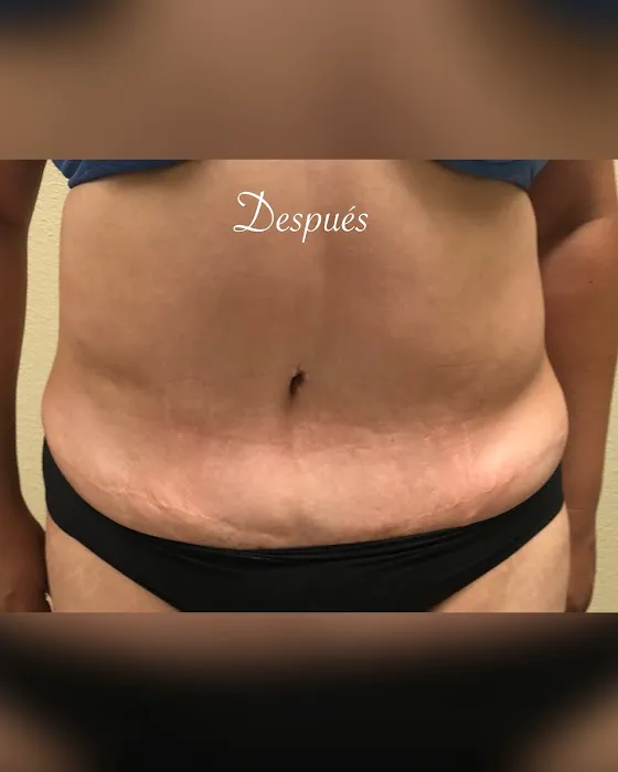 Oshun Body Wrap Picture 10