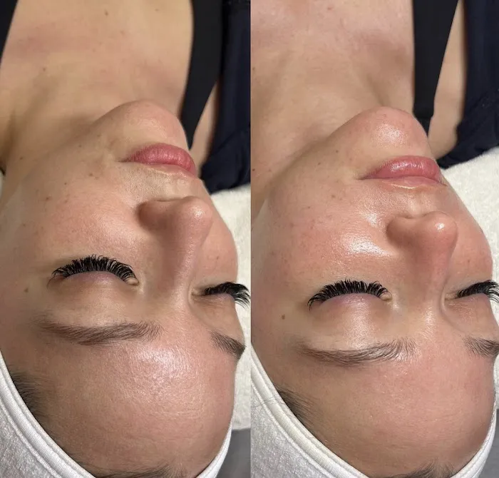 Glowing Silk Skin Picture 3