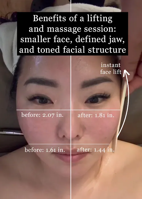 Kang Esthetic Picture 3