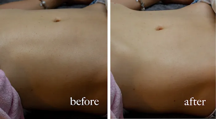 Kang Esthetic Picture 8