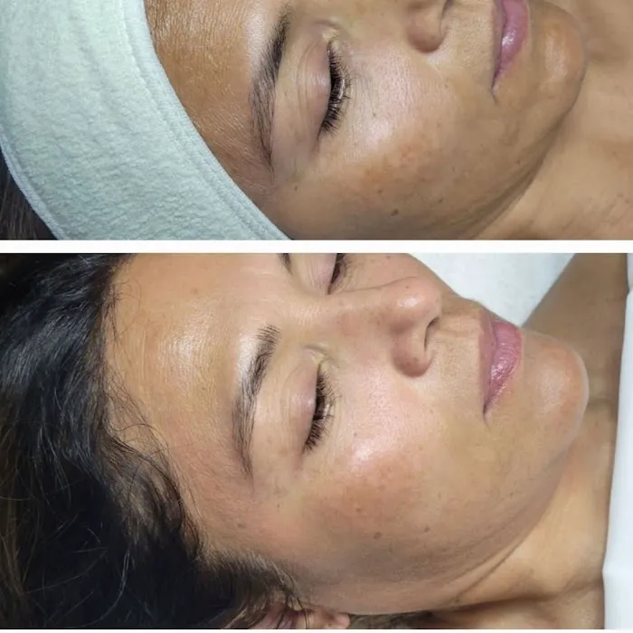 OG Beauty Ink & Aesthetics Picture 2