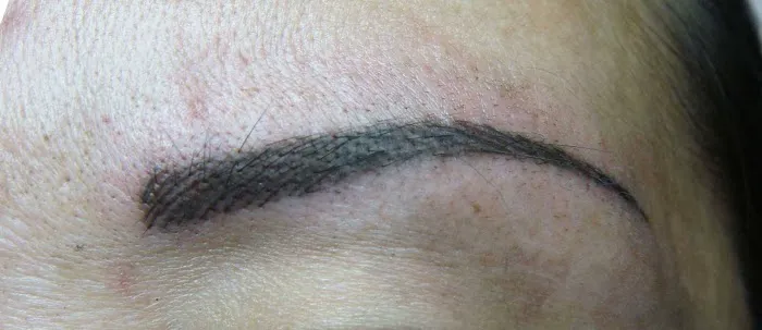 Xuan Lan Skin Care (aka Xuan Lan Beauty Clinic) Picture 7