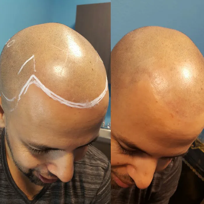 King Esthetics Picture 2