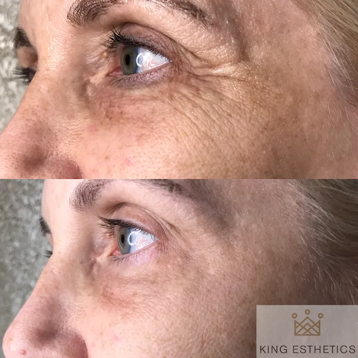 King Esthetics Picture 5