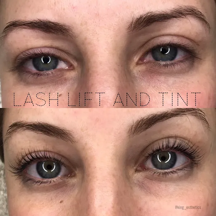 King Esthetics Picture 4