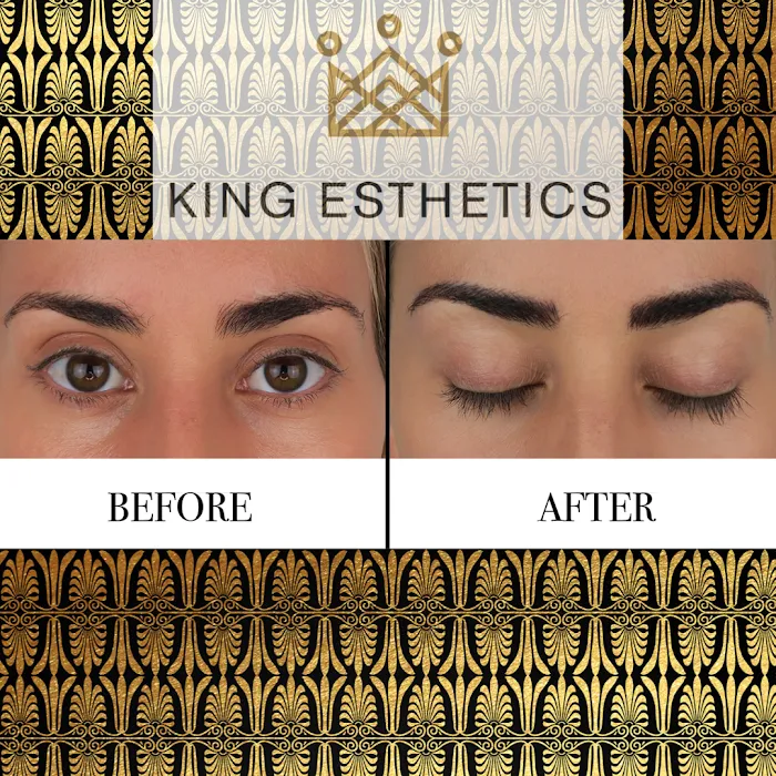King Esthetics Picture 6