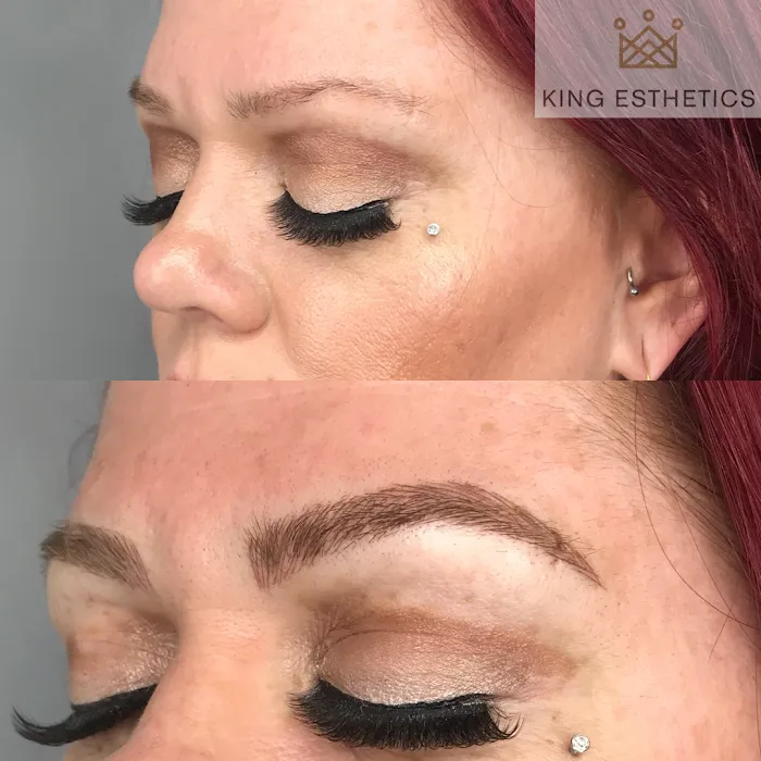 King Esthetics Picture 7