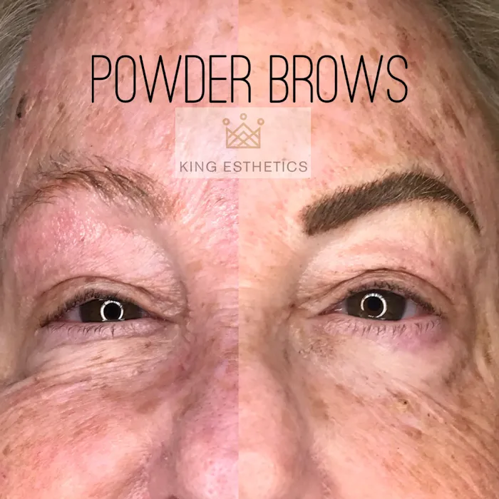 King Esthetics Picture 8