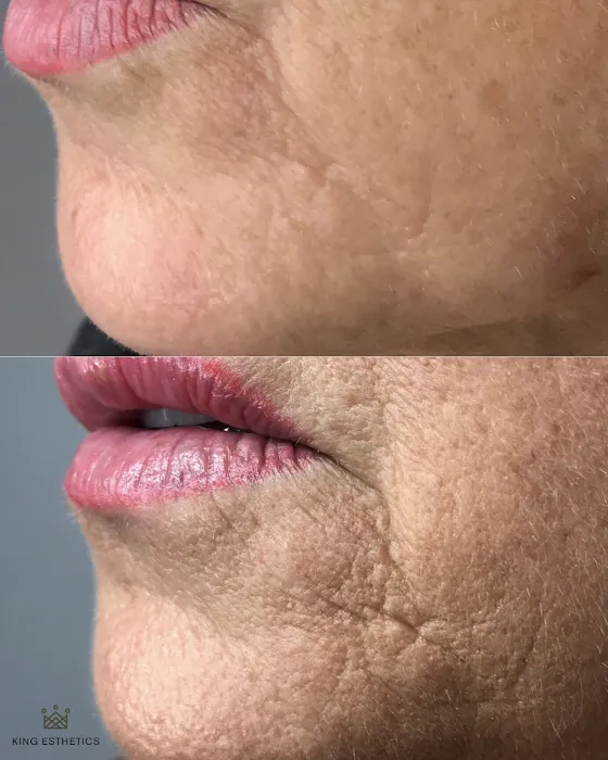 King Esthetics Picture 10