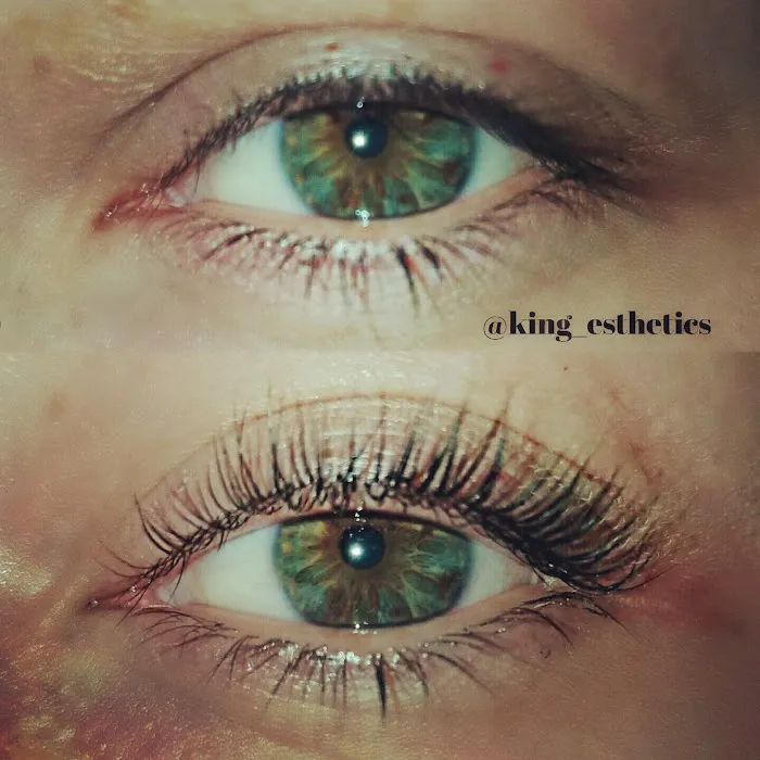 King Esthetics Picture 9