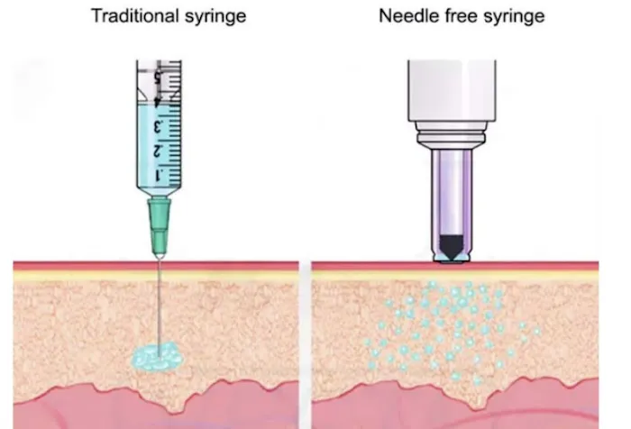 Shush Beauty Picture 2