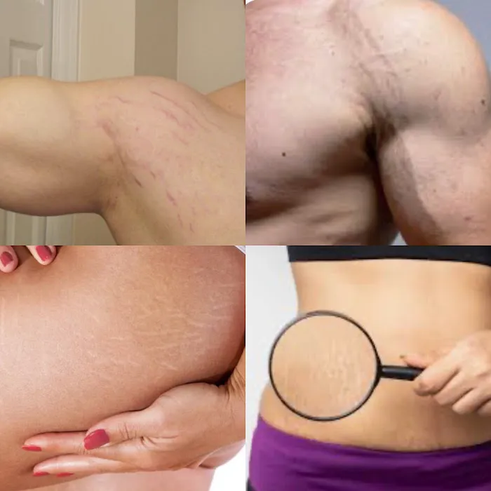 Shush Beauty Picture 4