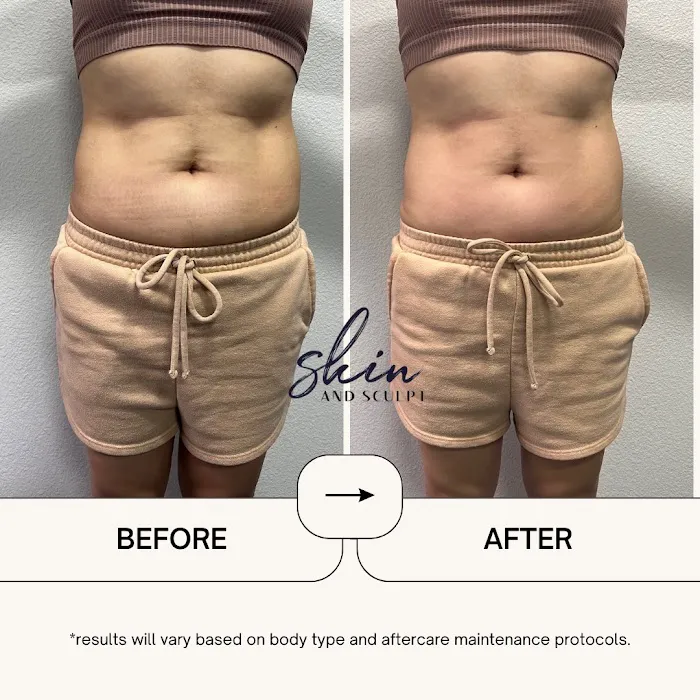 Skin & Sculpt Picture 10