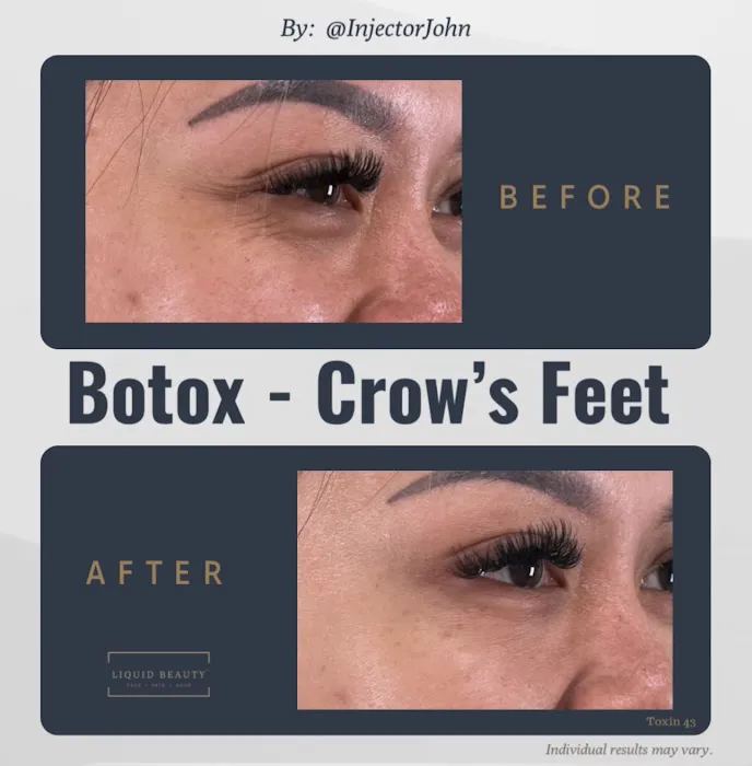 Liquid Beauty - Orange County Picture 7