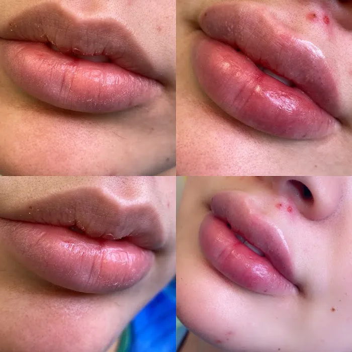 Lifted Beauty Med Spa Picture 2