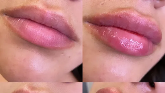 Lifted Beauty Med Spa Picture 3