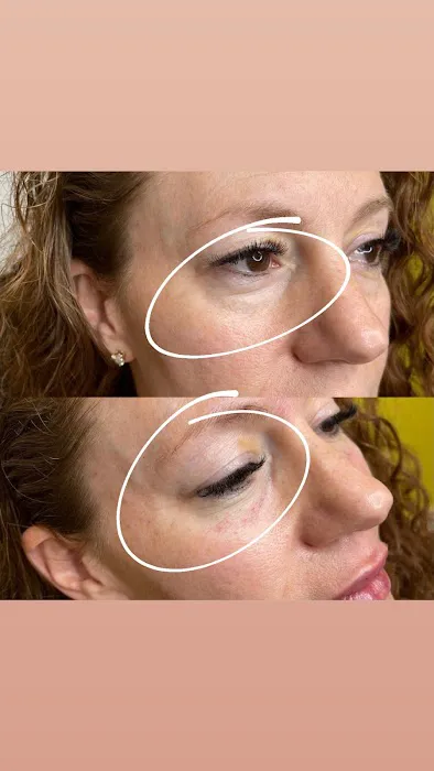 Lifted Beauty Med Spa Picture 1