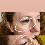 Lifted Beauty Med Spa