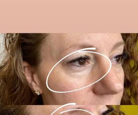 Lifted Beauty Med Spa