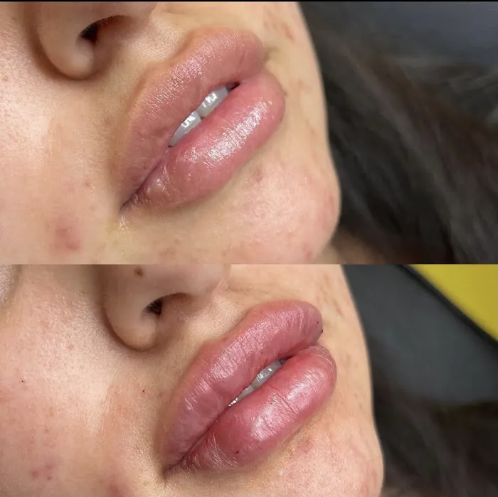 Lifted Beauty Med Spa Picture 5