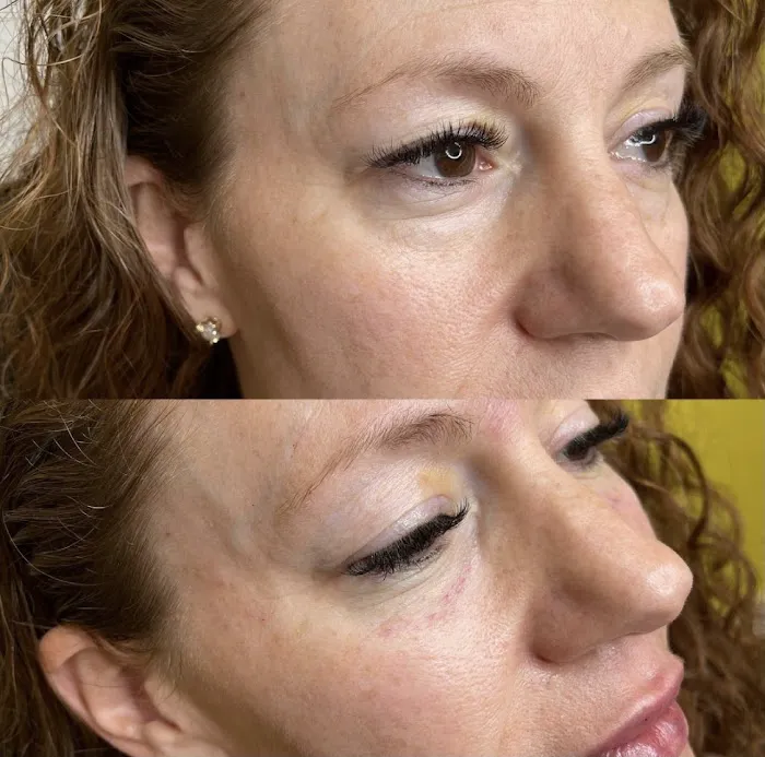 Lifted Beauty Med Spa Picture 6