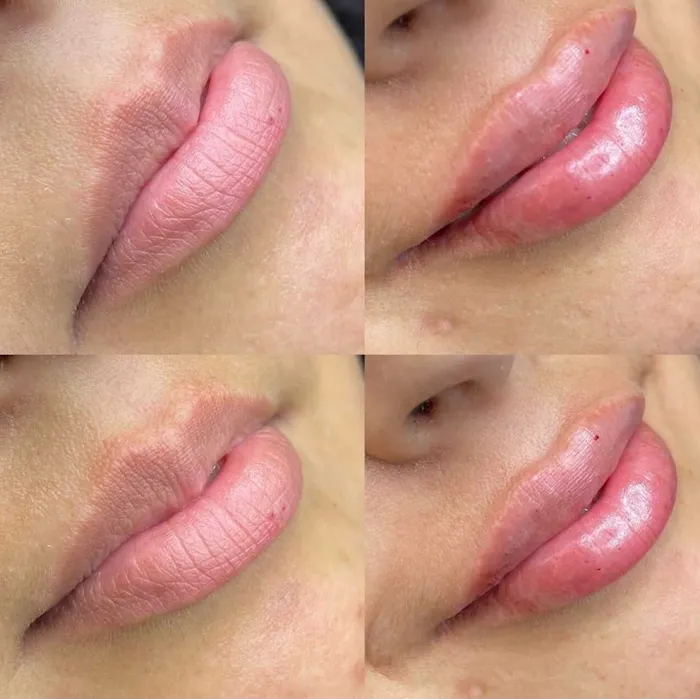 Lifted Beauty Med Spa Picture 8