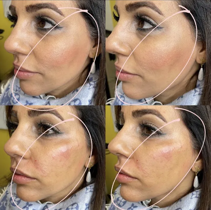 Lifted Beauty Med Spa Picture 10