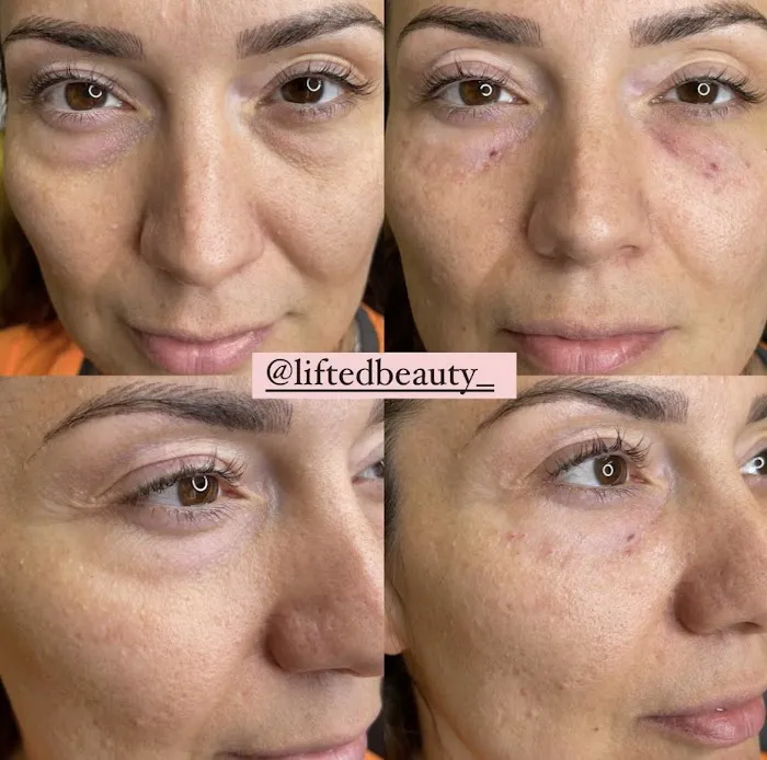 Lifted Beauty Med Spa Picture 9